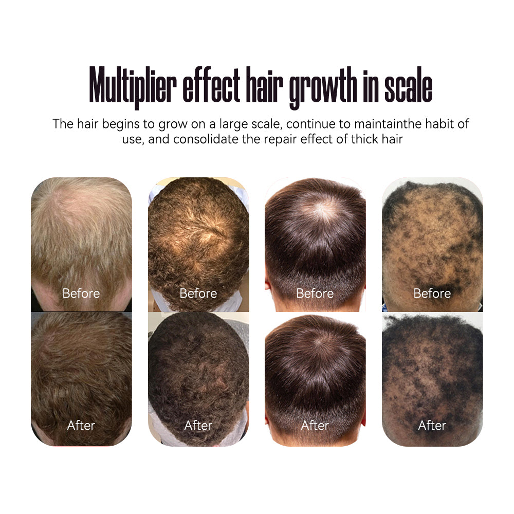 SAT Laser Hair Treatment System V2